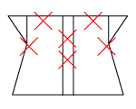 頸椎部のチェック図