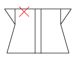 頸椎部のチェック図