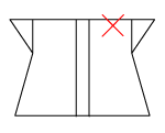 頸椎部のチェック図