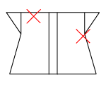 頸椎部のチェック図