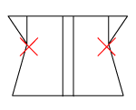 頸椎部のチェック図