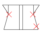頸椎部のチェック図