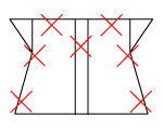 頸椎部のチェック図