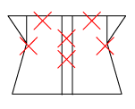 頸椎部のチェック図