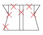 頸椎部のチェック図