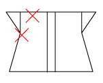 頸椎部のチェック図