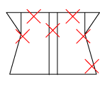 頸椎部のチェック図