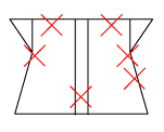頸椎部のチェック図