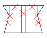 頸椎部のチェック図