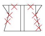 頸椎部のチェック図