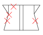 頸椎部のチェック図