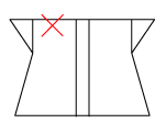 頸椎部のチェック図