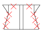 頸椎部のチェック図
