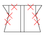 頸椎部のチェック図