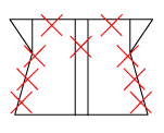 頸椎部のチェック図