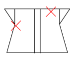頸椎部のチェック図
