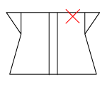 頸椎部のチェック図