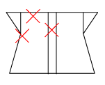 頸椎部のチェック図