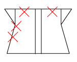 頚椎部のチェック図
