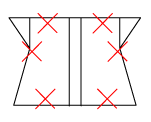 頸椎部のチェック図