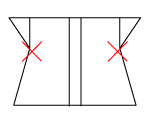 頸椎部のチェック図