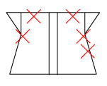 頸椎部のチェック図
