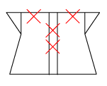頸椎部のチェック図