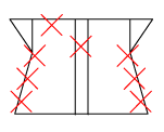 頸椎部のチェック図