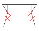 頸椎部のチェック図