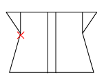 頸椎部のチェック図