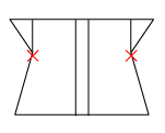 頸椎部のチェック図