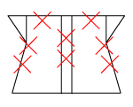 頸椎部のチェック図
