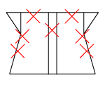 頸椎部のチェック図