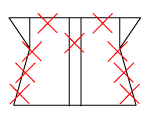 頸椎部のチェック図