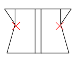 頸椎部のチェック図